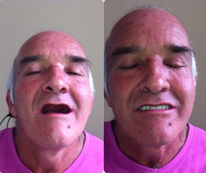 CHENCHO - LUIS EVELIO MONTOYA