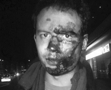 PADRE DE ESTUDIANTE AGREDIDO EN BOGOT� PIDE RECAPTURA DE RESPONSABLES